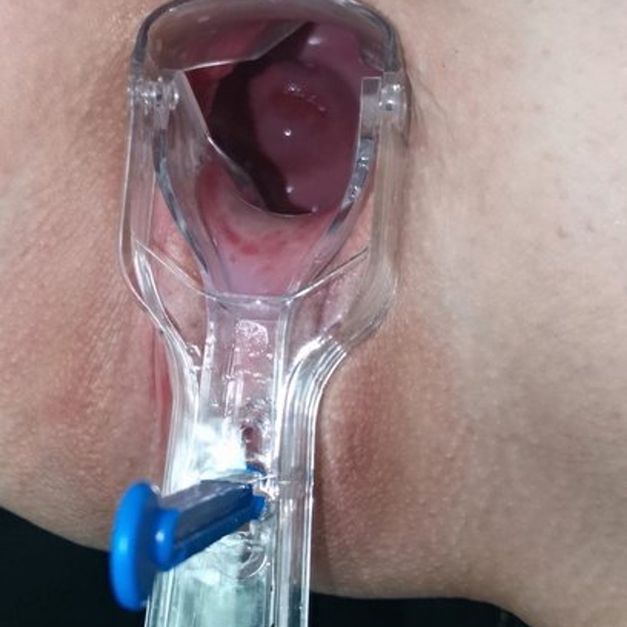 Rumiaaanka - speculum vaginal close up