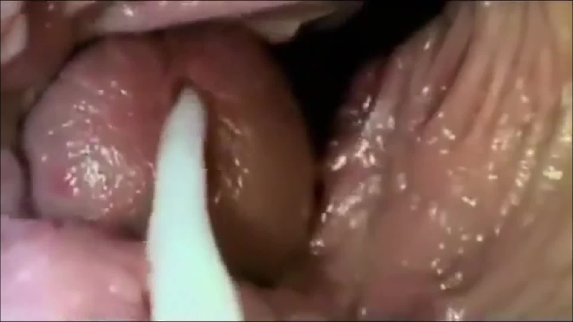 Internal camera and cum inside vagina