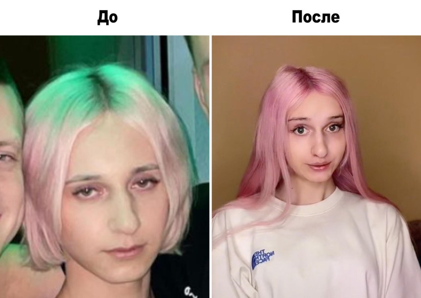 Даша корейка до и после