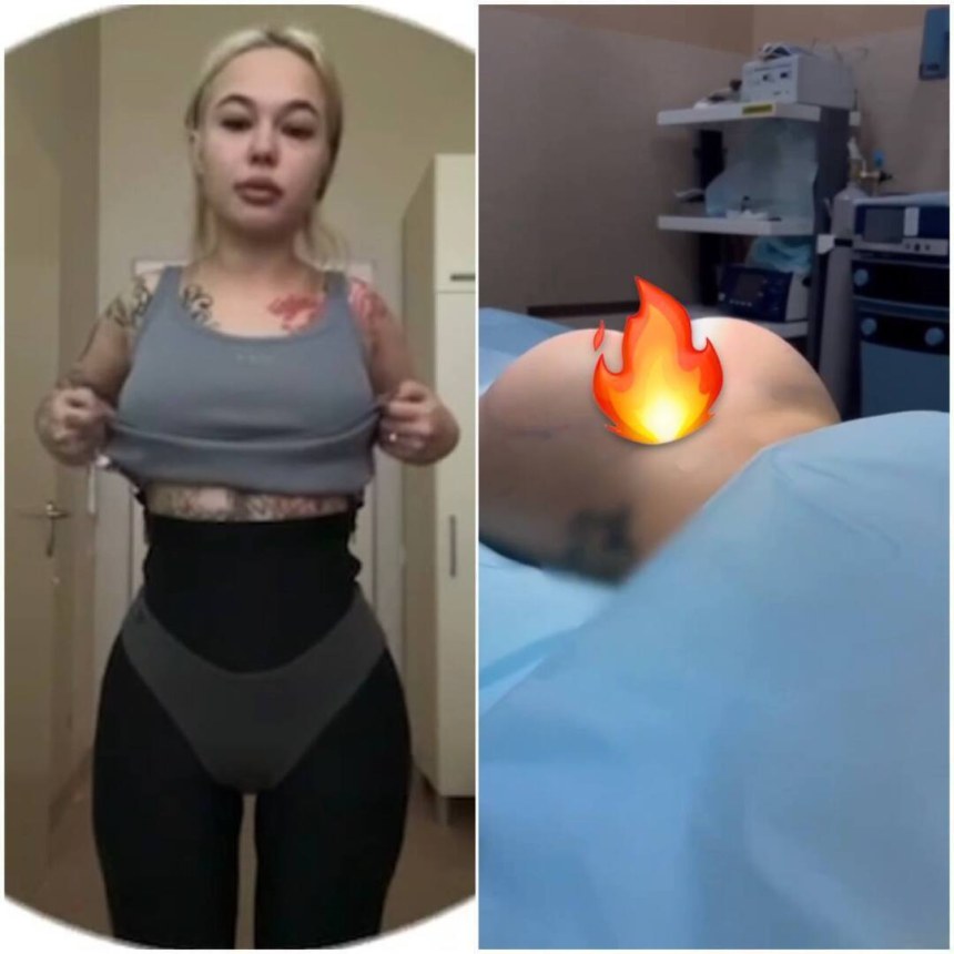 Инстасамка операция на ягодицы